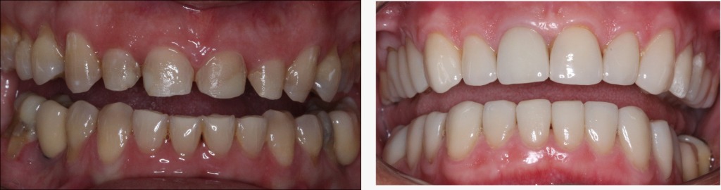 Paciente-de-estetica-2 (1)